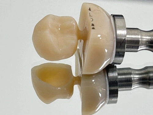 Same-Day Restoration